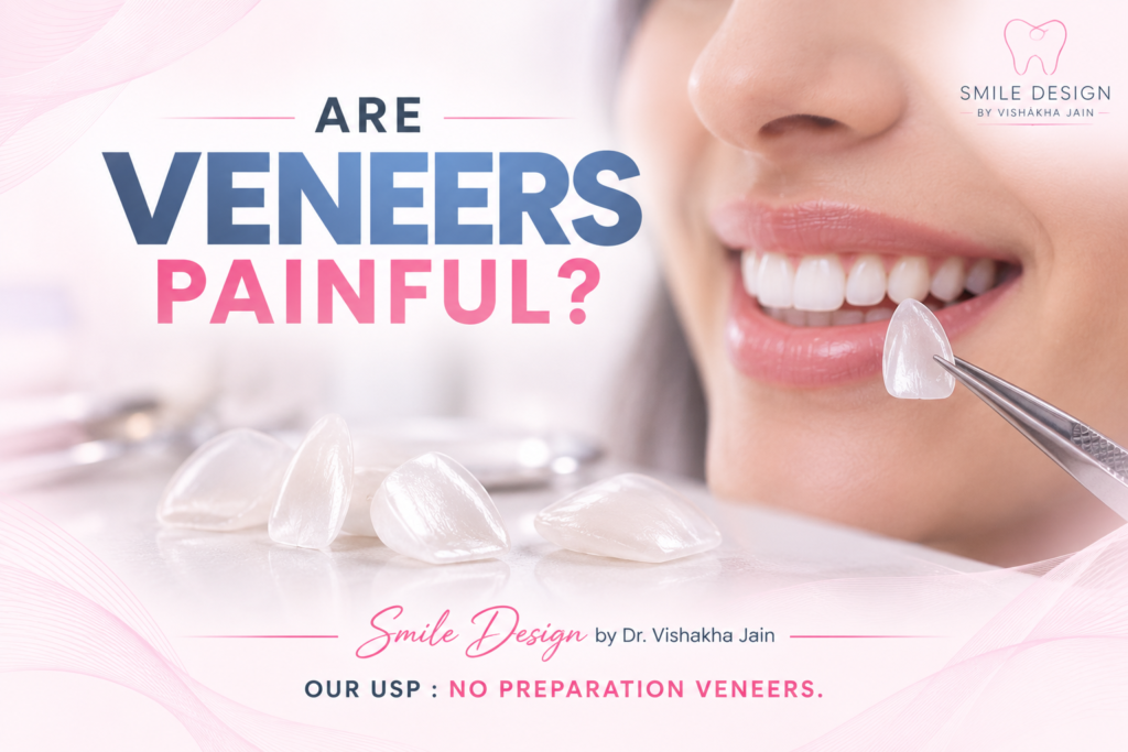 Cost of Invisible Braces & Veneers: Are They Worth the Investment?
